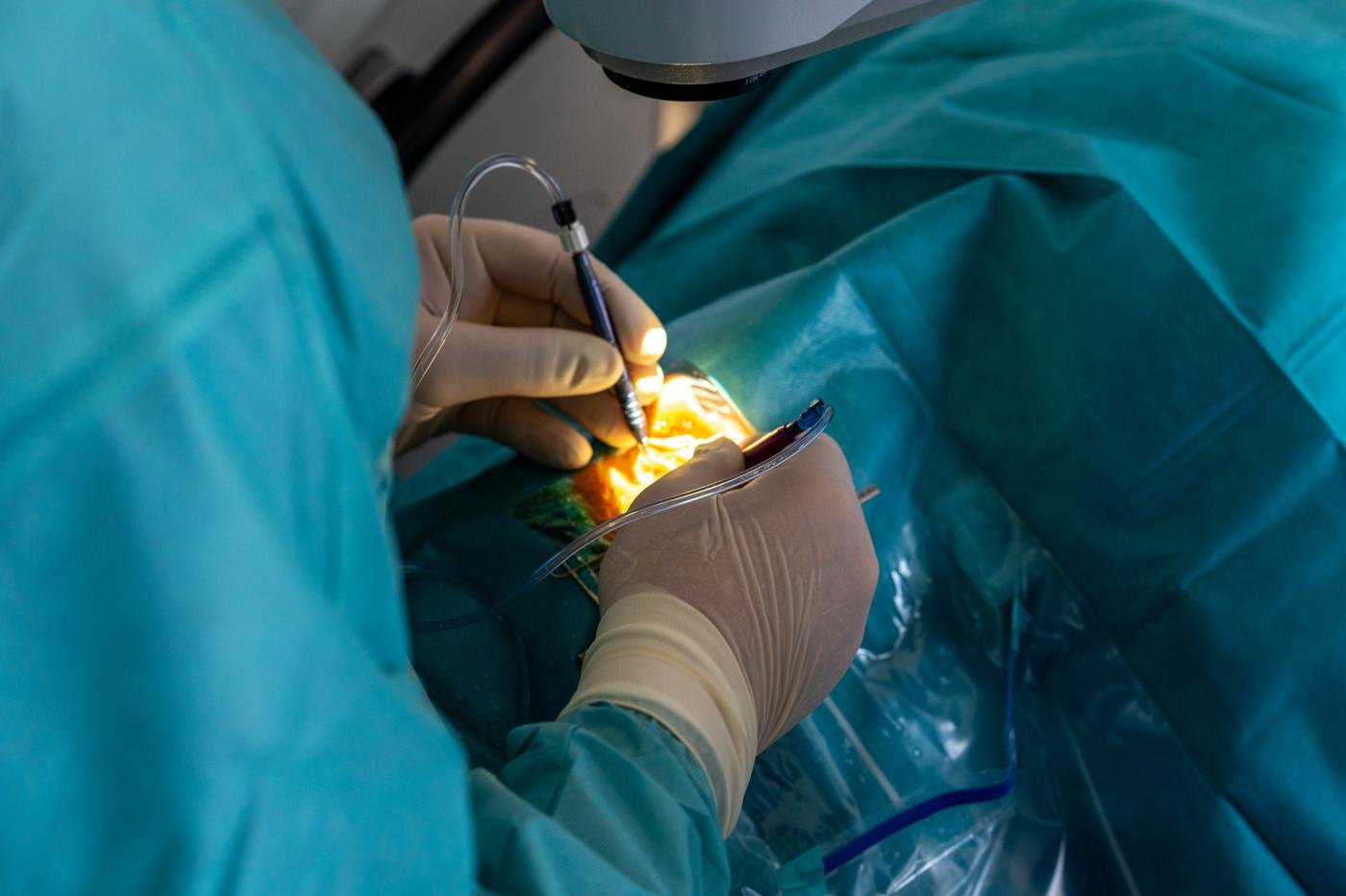 Operation am Auge unter OP-Licht